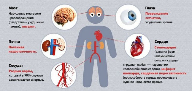 10 рецептов лечения гипертонии. Снижаем давление безопасно и без вреда для организма