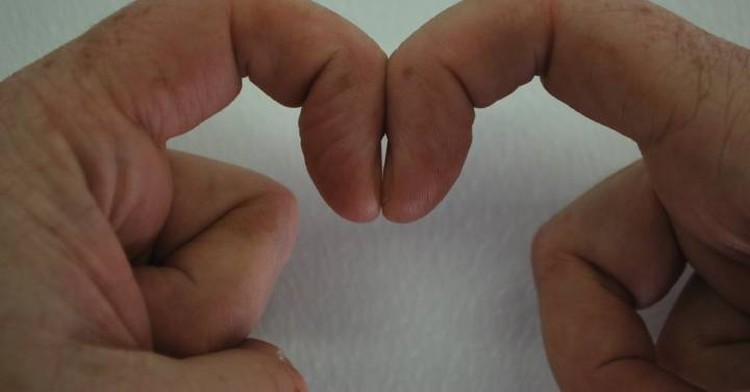 Тест на аневризму проще простого: растопырив пальцы, человек может узнать, не грозит ли ему внезапная смерть аорты, пальцы, палец, легких, большой, между, мозга, поверх, поведение, человека, теста, ладони, активность, указывает, более, особенно, таких, переплетая, выявить, университета