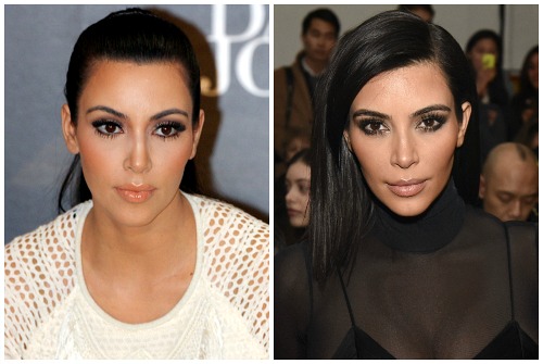 Какую пластику делала Ким Кардашьян: фото до и после