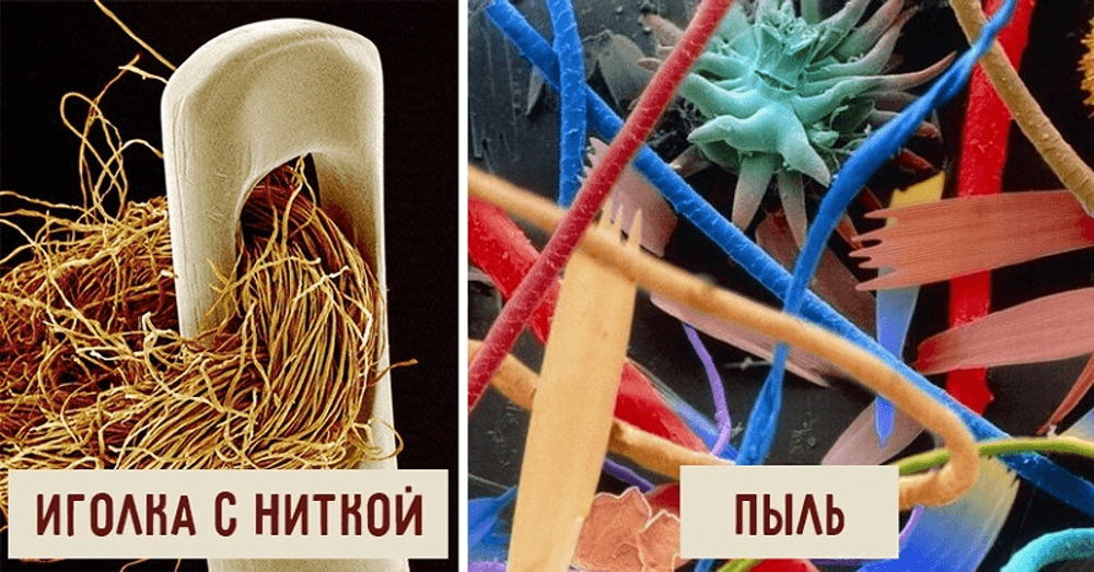 Угадайте, что это такое! Фото, сделанные электронным микроскопом