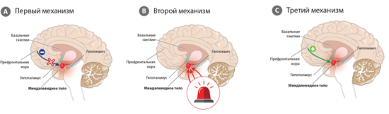 Три механизма развития тревожных расстройств