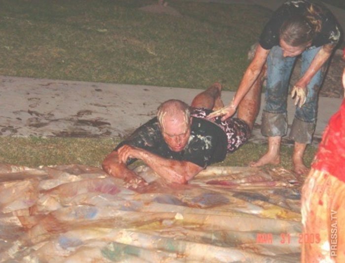 Люди рассказывают о своих самых глупых травмах 