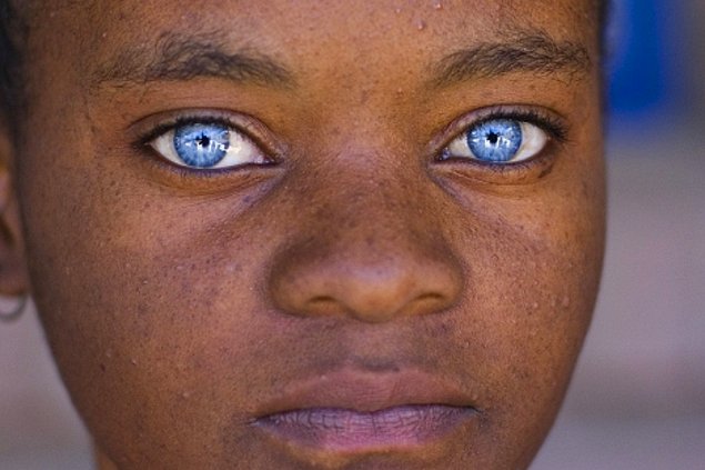 Чудо природы: 15 темнокожих малышей с голубыми глазами