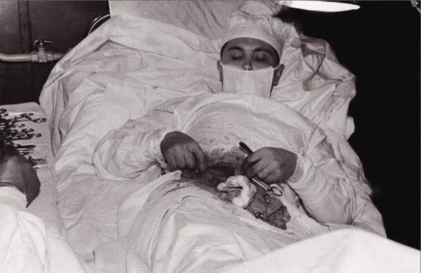 29 апреля 1961 года врач шестой советской антарктической экспедиции Леонид Рогозов почувствовал слабость и боли в правой подвздошной области, а также повышение температуры тела.
