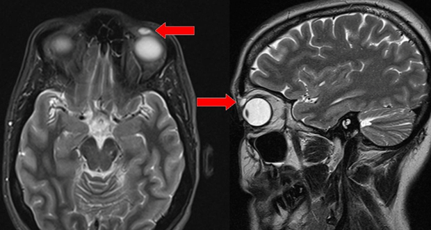 10 кошмарных медицинских случаев 10 кошмарных медицинских случаев медицина и здоровье,происшествия,странности
