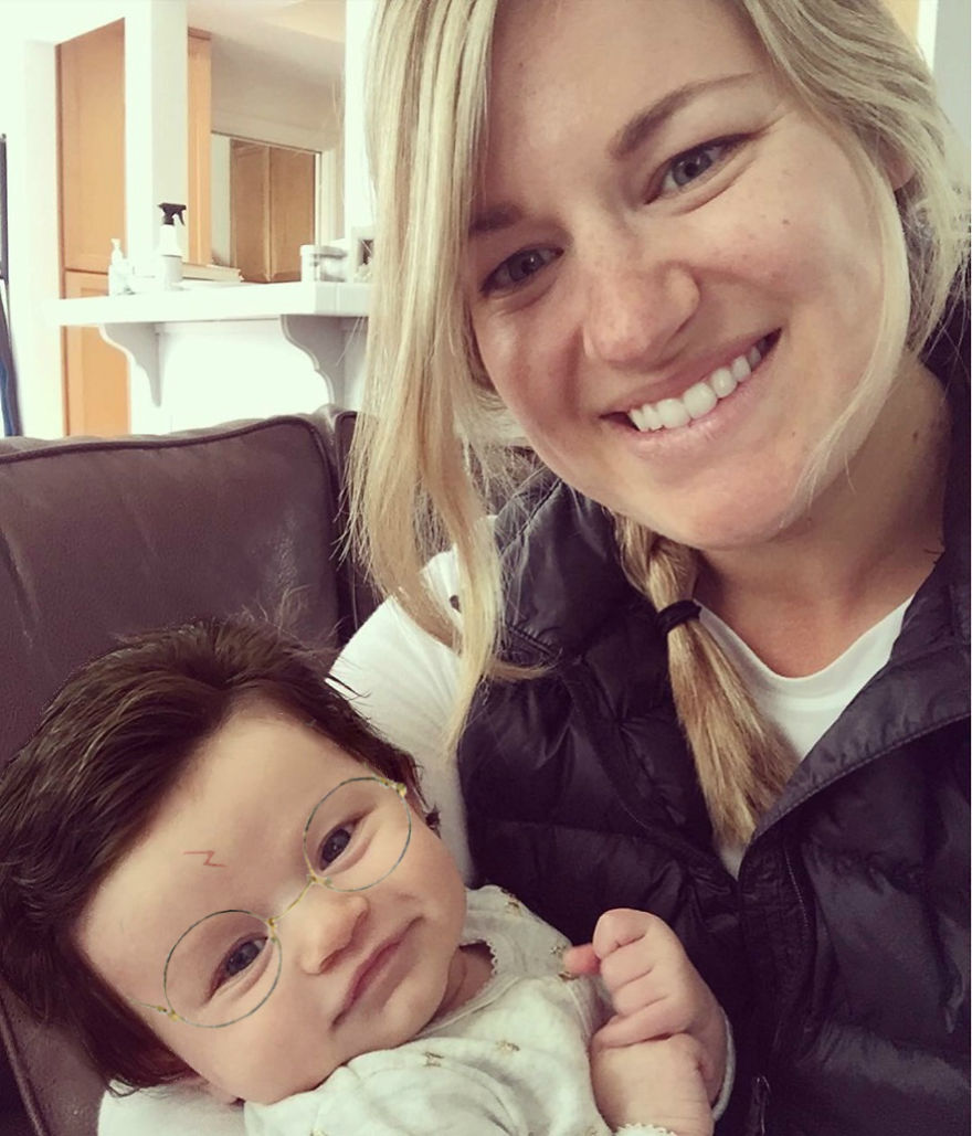 ребенок родился с пышной шевелюрой 