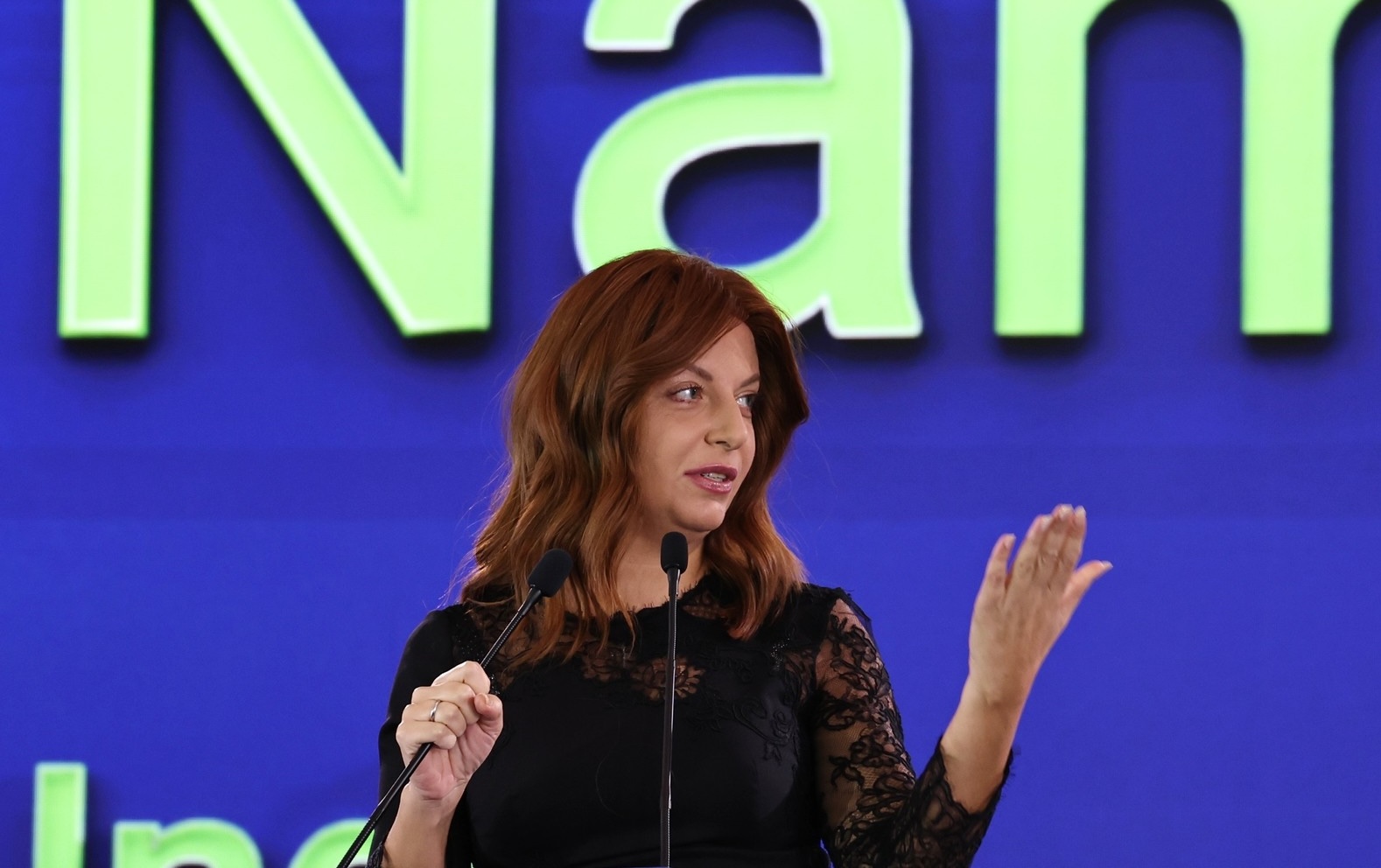 «Облысела, вкус пропадает, кожа портится»: Маргарита Симоньян рассказала о борьбе с раком