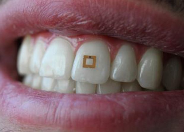 Золотой сенсор на зуб, мошенничество на сбое в Telegram