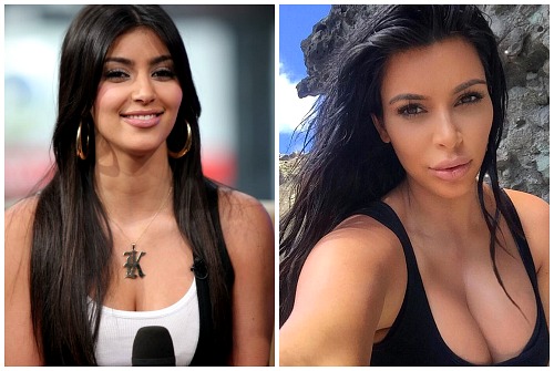 Какую пластику делала Ким Кардашьян: фото до и после