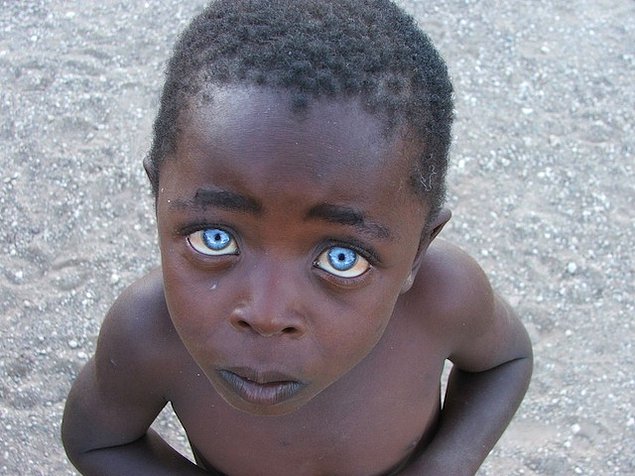 Чудо природы: 15 темнокожих малышей с голубыми глазами