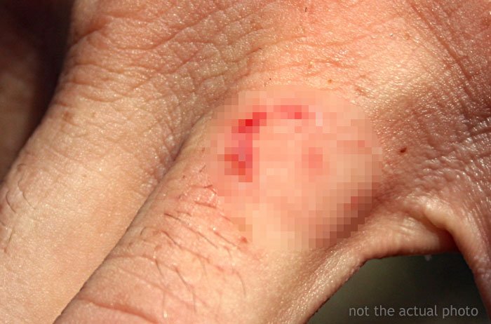 Люди рассказывают о своих самых глупых травмах 