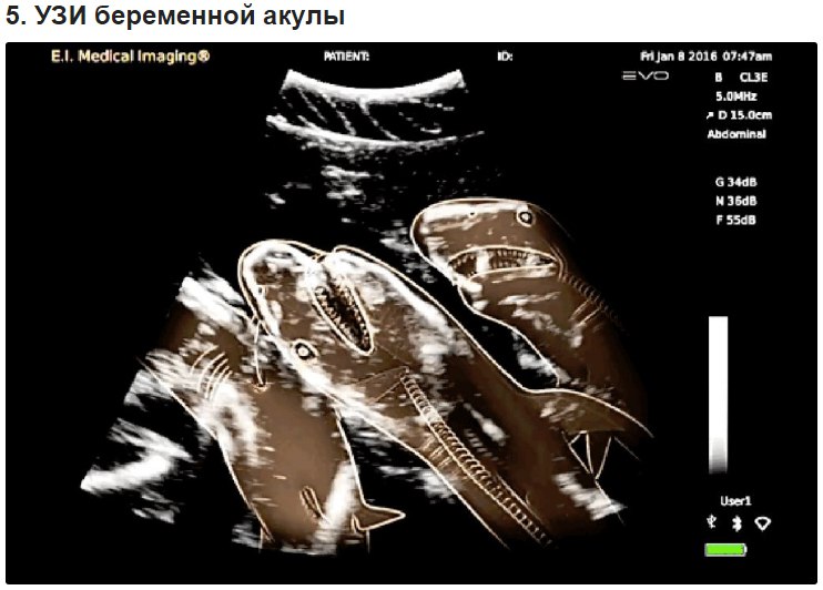 10 удивительных рентгеновских снимков беременных животных