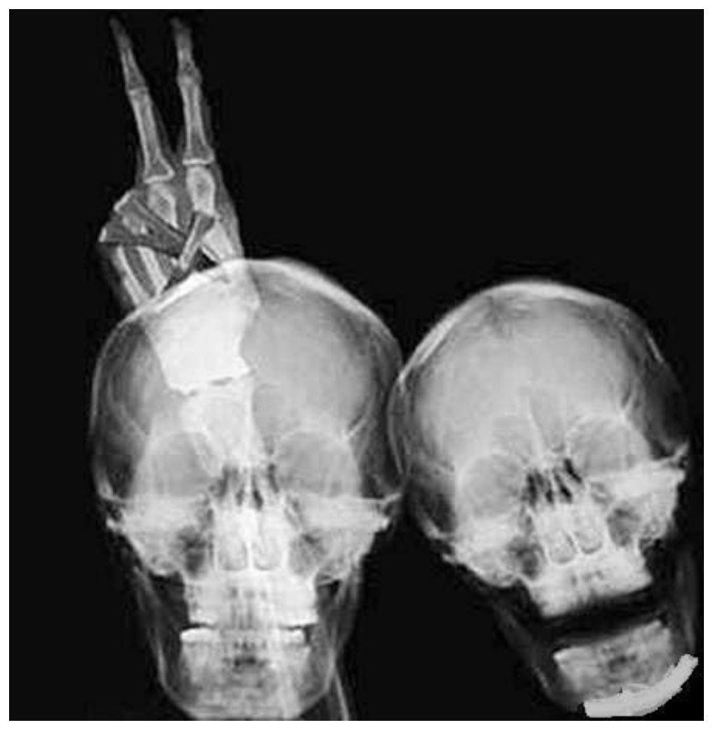 Мир в рентгеновских лучах - вид искусства, где видна изнанка бытия внутри, интересное, искусство, рентген, скелет, снимки
