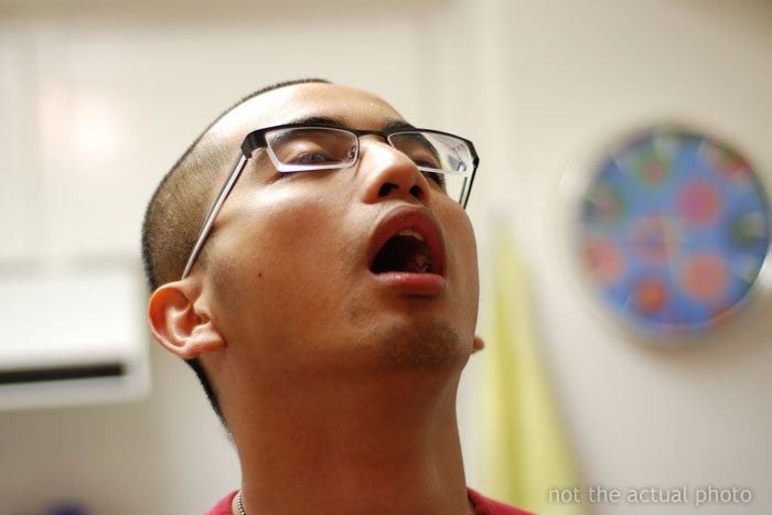 Люди рассказывают о своих самых глупых травмах 