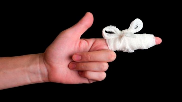 Эти три странные ситуации происходили с моими пальцами на протяжении всей жизни, что будет дальше, остаётся только гадать