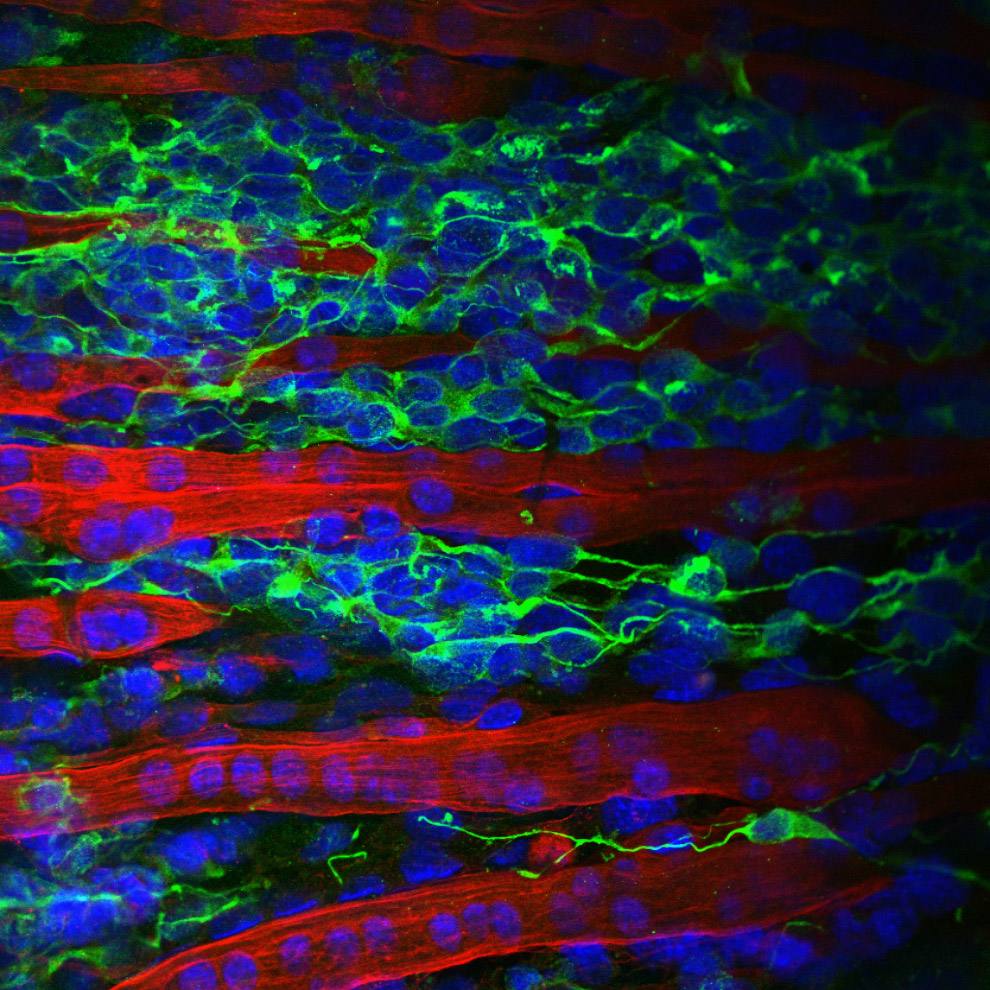 соединение между искусственно сконструированными нервными клетками (зеленый цвет) и мышечными волокнами (красный цвет)
