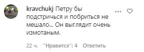 Внешний вид мужа онкобольной Анастасии Заворотнюк ужаснул россиян