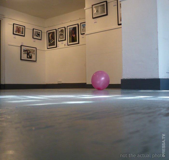 Люди рассказывают о своих самых глупых травмах 