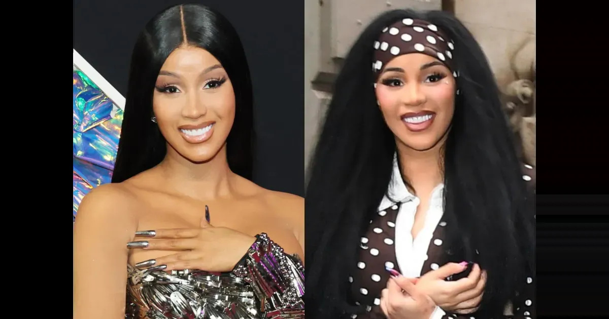 Карди Би заподозрили в новой пластической операции