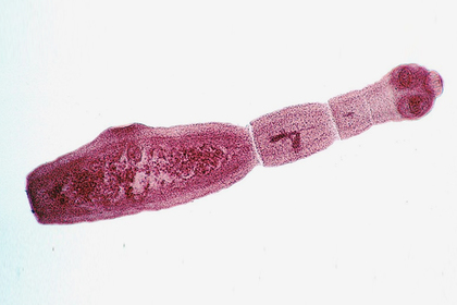 Домашние животные оказались смертельно опасны. Проверьте вашего питомца немедленно! животных, червей, Американские, Колумбии, случай, печеночного, гельминтоза, домашнего, зафиксирован, времени, зараженные, животные, появились, Британской, Канаде, Западной, хирургическое, ОнтариоЗараженных, червем, вылечить