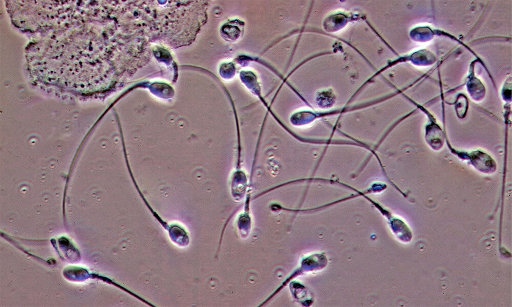 10 кошмарных медицинских случаев 10 кошмарных медицинских случаев медицина и здоровье,происшествия,странности