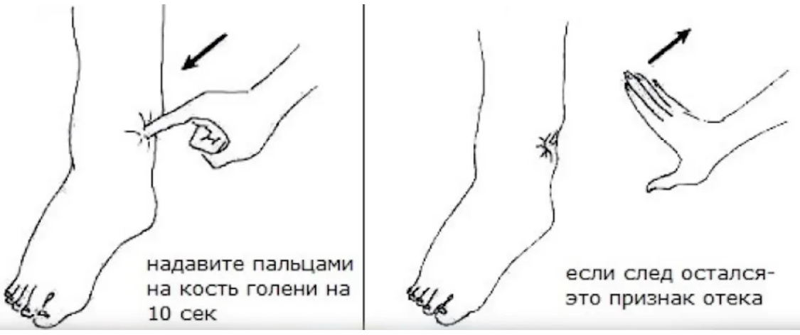 Ходьба не отрывая стоп: активный лимфодренаж, выводим лишнюю воду и отеки лимфы, движение, появляется, активно, нагрузку, усталость, ногах, упражнение, быстро, постепенно, именно, улучшать, только, области, очень, клапаны, будет, можно, застаивается, полезно