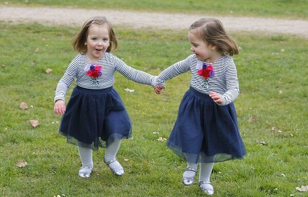 Девочки-близняшки родились сросшимися. Их разделили — и вот, какие красавицы они сегодня! Дети,Жизнь,Истории,позитив