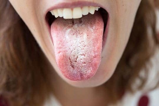Читай по зубам! 5 признаков болезней, которые можно обнаружить во рту болезни,здоровье и медицина,зубы,организм