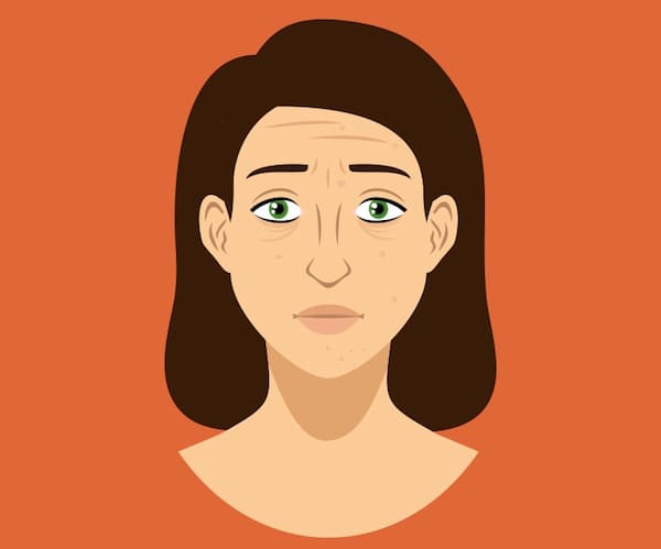 4 продукта, которые портят ваше лицо. Это факт! 4 продукта, которые портят ваше лицо. Это факт! полезные советы,разное