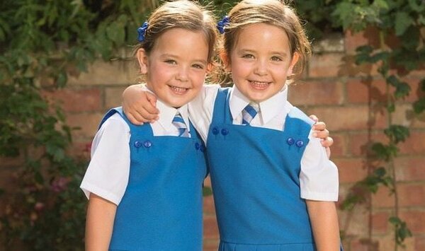 Девочки-близняшки родились сросшимися. Их разделили — и вот, какие красавицы они сегодня! Дети,Жизнь,Истории,позитив