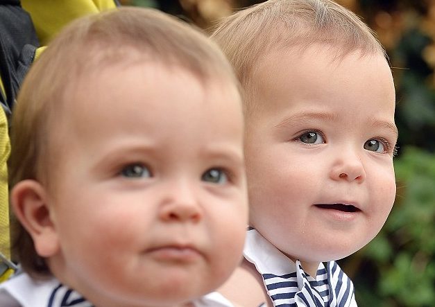 Девочки-близняшки родились сросшимися. Их разделили — и вот, какие красавицы они сегодня! Дети,Жизнь,Истории,позитив