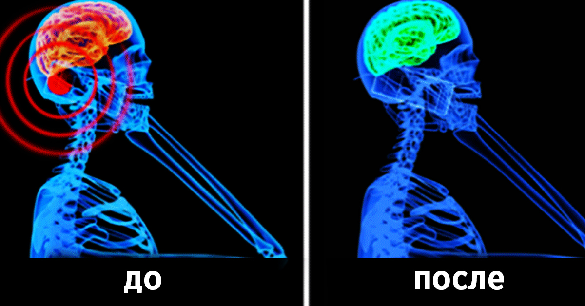 Картинки излучение от телефона