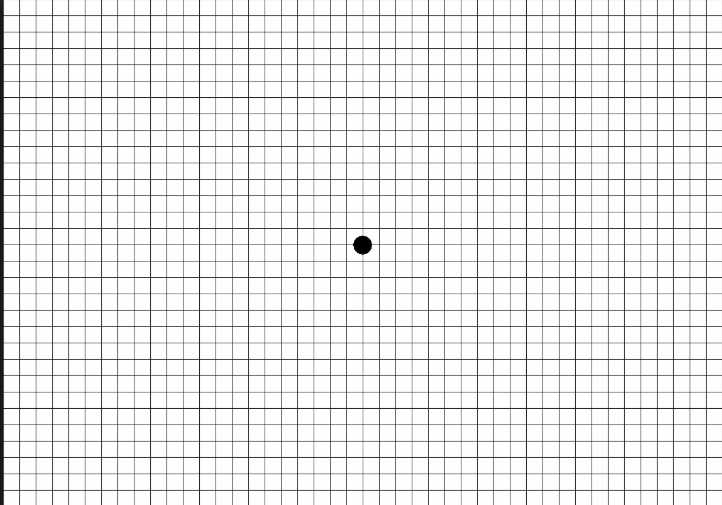 Тест Амслера поможет вовремя выявить заболевание глаз и сохранить зрение!