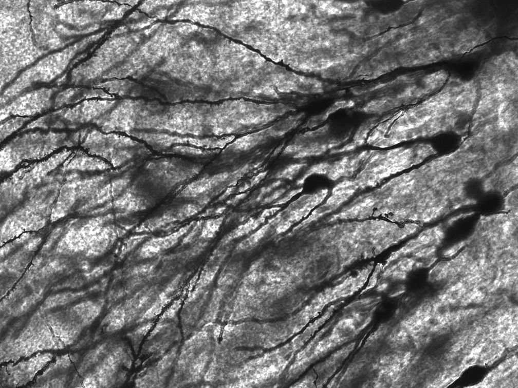 Окрашенные по методу Гольджи человеческие нейроны в гиппокампальной ткани