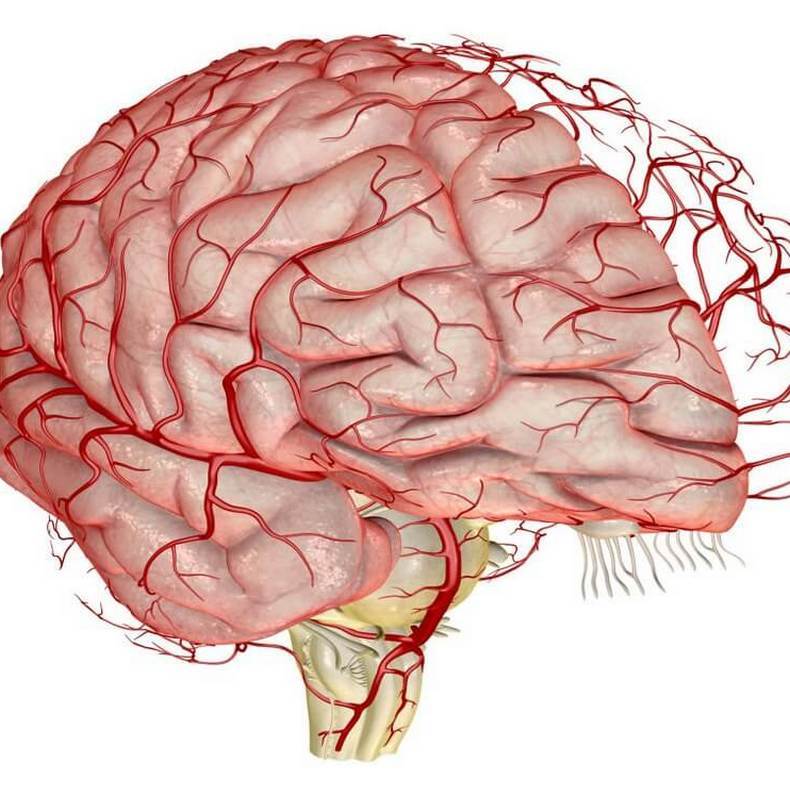 7 признаков инсульта атеросклероз,инсульт,ишемическая болезнь,кровоизлияние,кровообращение мозга,сосуды,тромб