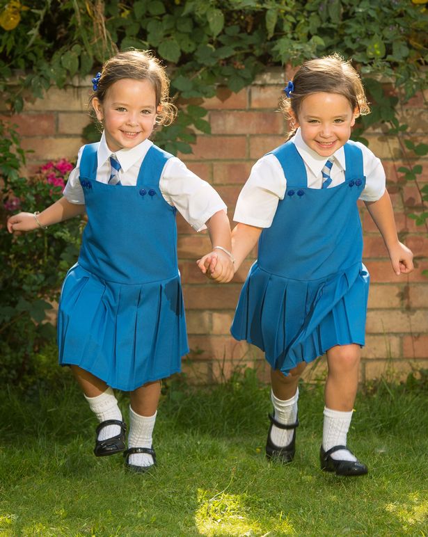 Девочки-близняшки родились сросшимися. Их разделили — и вот, какие красавицы они сегодня! Дети,Жизнь,Истории,позитив