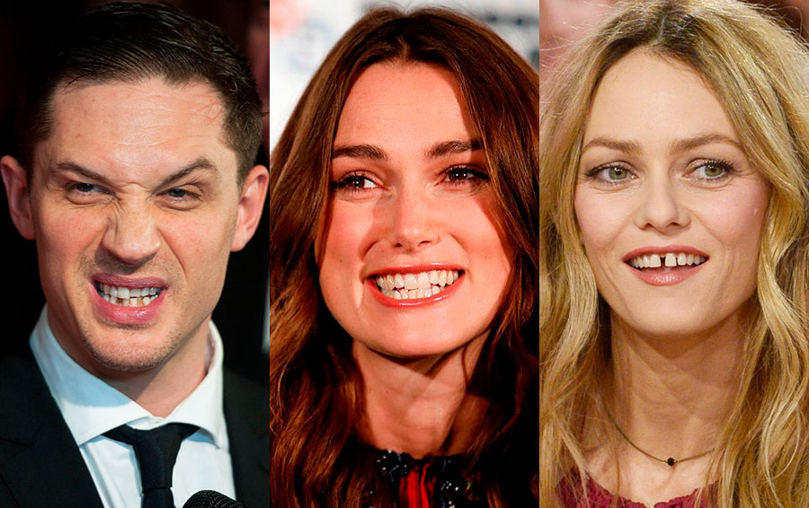 Не Голливудская улыбка: 9 звезд, у которых проблемы с зубами