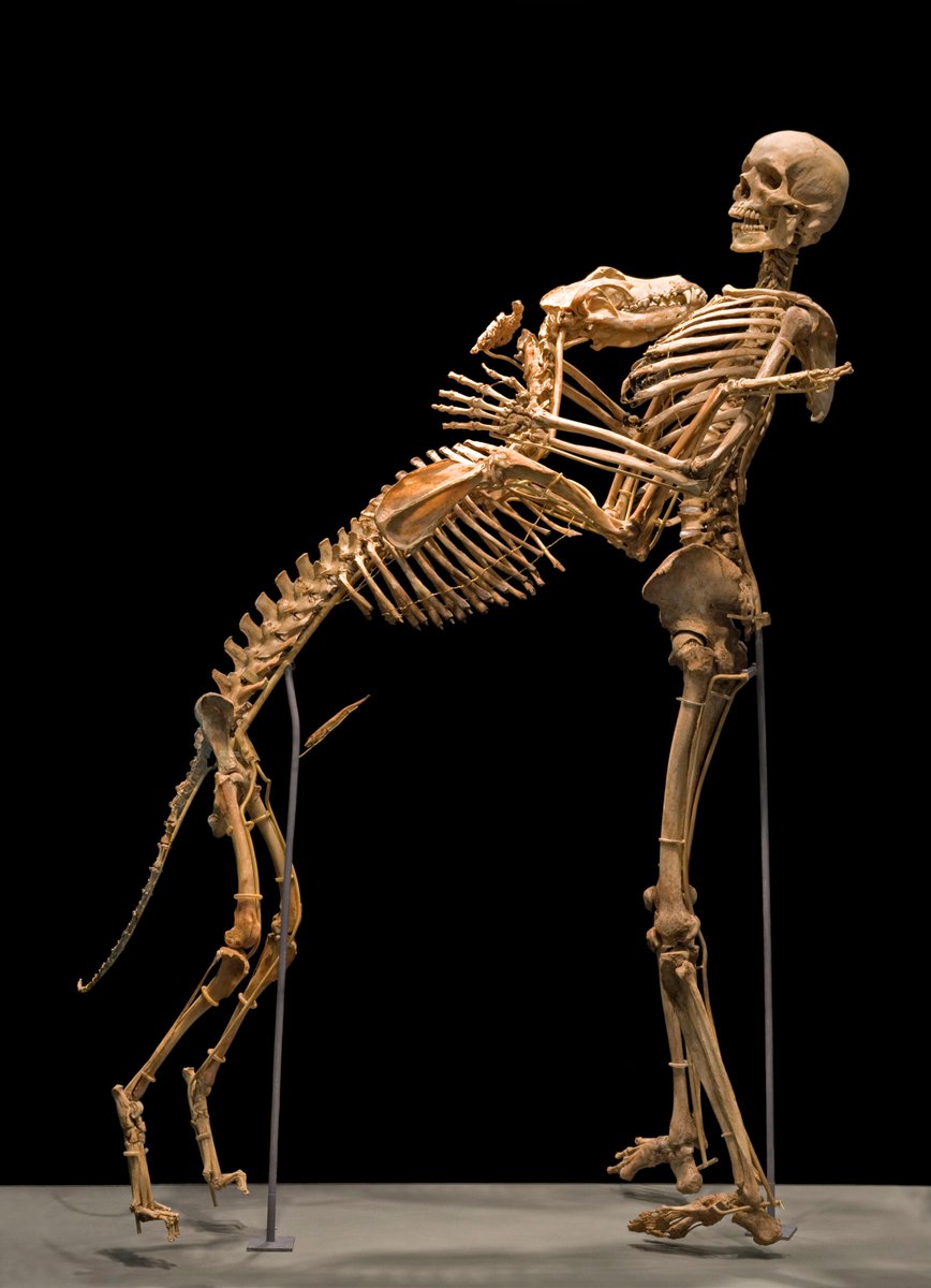 Фибродисплазия скелет