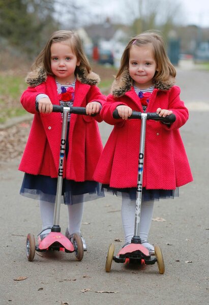 Девочки-близняшки родились сросшимися. Их разделили — и вот, какие красавицы они сегодня! Дети,Жизнь,Истории,позитив