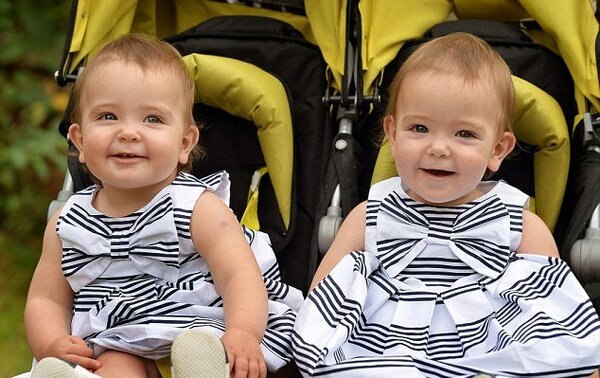 Девочки-близняшки родились сросшимися. Их разделили — и вот, какие красавицы они сегодня! Дети,Жизнь,Истории,позитив