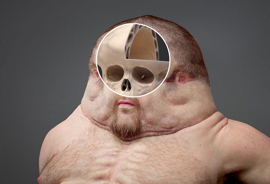 единственный человек который может выжить автокатастрофе 