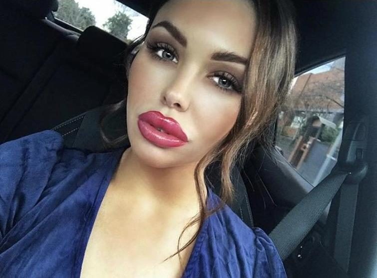 25 чудиков, которые решили увеличить губы, но что-то пошло не так 25 чудиков, которые решили увеличить губы, но что-то пошло не так