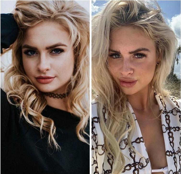 25 чудиков, которые решили увеличить губы, но что-то пошло не так 25 чудиков, которые решили увеличить губы, но что-то пошло не так