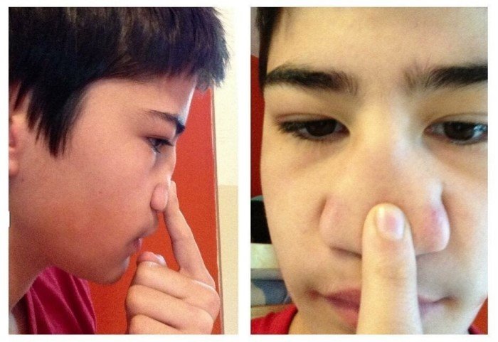 15 людей, отмеченных самой матушкой-природой 15 людей, отмеченных самой матушкой-природой