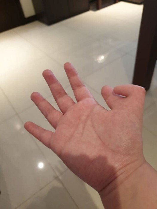 15 людей, отмеченных самой матушкой-природой 15 людей, отмеченных самой матушкой-природой