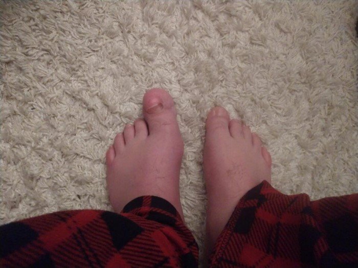 15 людей, отмеченных самой матушкой-природой 15 людей, отмеченных самой матушкой-природой