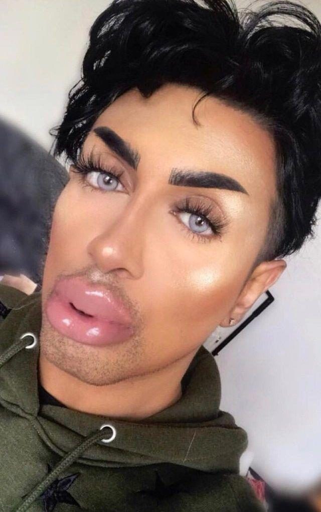 25 чудиков, которые решили увеличить губы, но что-то пошло не так 25 чудиков, которые решили увеличить губы, но что-то пошло не так