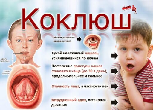 Братство, объединенное шрамами: от каких болезней делают прививки против, прививка, после, прививки, в виде, свинки, введена, детей, от кори, заболевание, вакцины, всего, живой, вакцинация, вакцину, от оспы, через, вакцина, от четырех, раствора