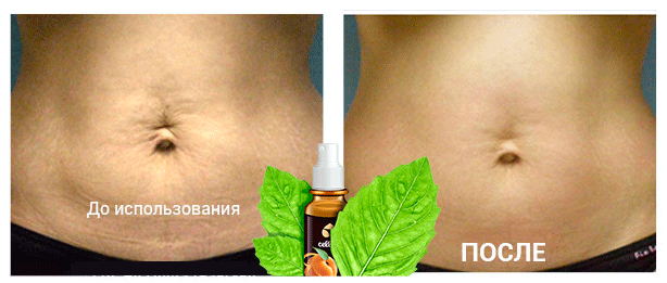 Cellufit-до-и-после