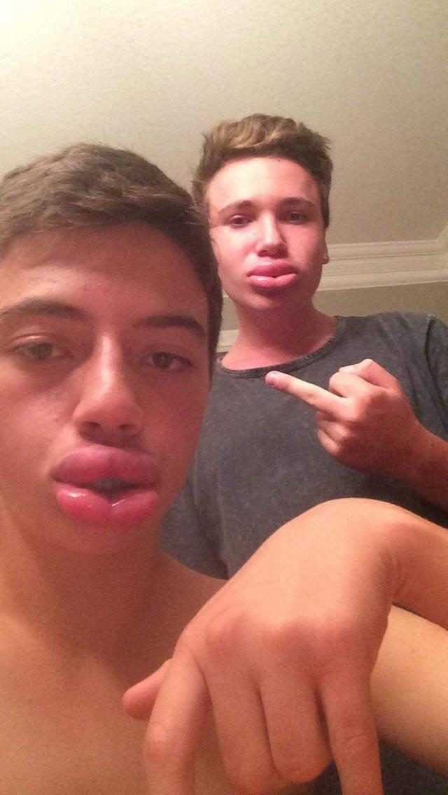 25 чудиков, которые решили увеличить губы, но что-то пошло не так 25 чудиков, которые решили увеличить губы, но что-то пошло не так